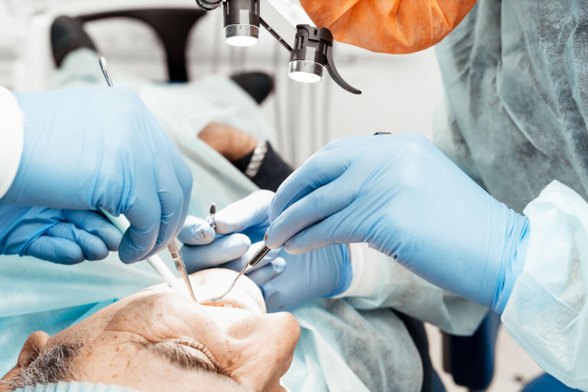 Tooth Extraction