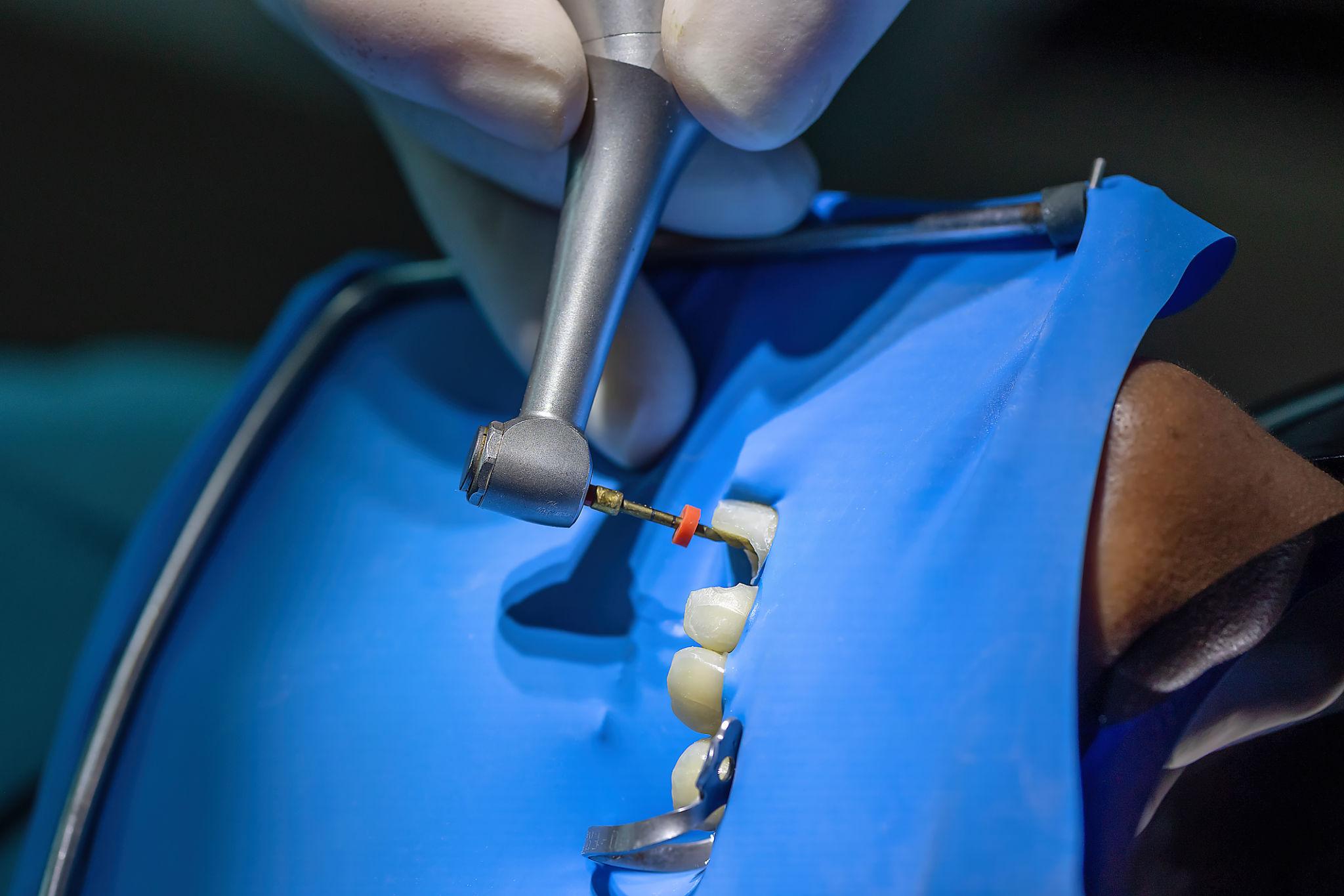 Rotary Endodontics